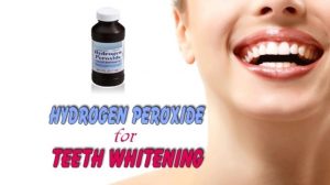 Hydrogen Peroxide for teeth whitening