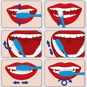 How to Brush Your Teeth Correctly