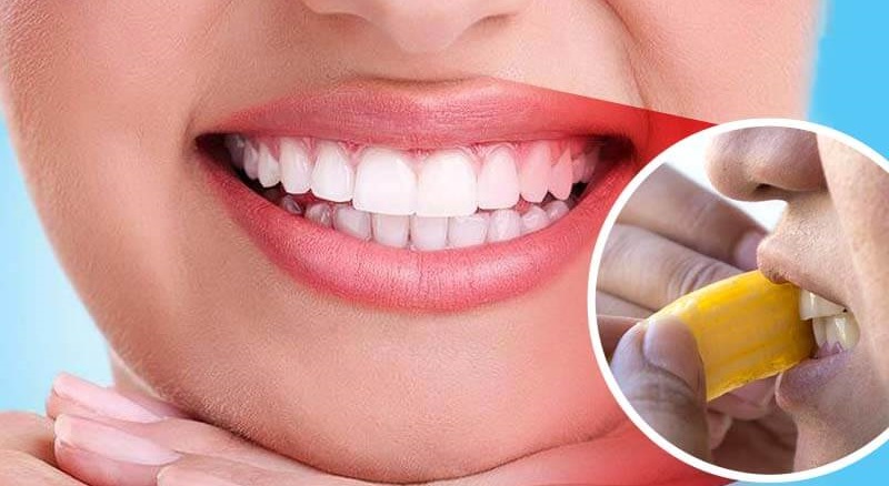 How to Whiten Teeth with Banana Peel
